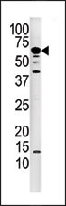 AP15292PU-N - PPP3CA / Calcineurin A
