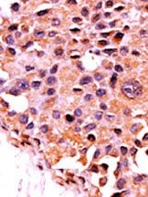 AP15292PU-N - PPP3CA / Calcineurin A