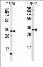 AP15286PU-N - CTDSP2