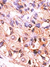 AP15285PU-N - Protein phosphatase 1F / PPM1F