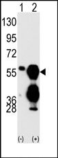 AP15285PU-N - Protein phosphatase 1F / PPM1F