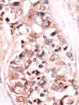 AP15278PU-N - DUSP14 / MKP6