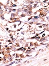 AP15276PU-N - DUSP13