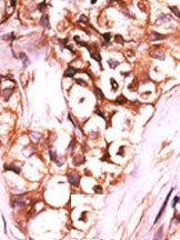 AP15269PU-N - DUSP8 / VH5