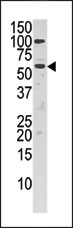 AP15195PU-N - Choline kinase alpha