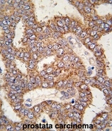 AP15199PU-N - TRPM8