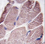 AP15233PU-N - PTPN21 / PTPD1