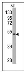 AM11059PU-N - Superoxide dismutase 2 / SOD2