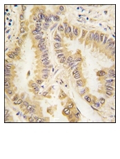 AM11059PU-N - Superoxide dismutase 2 / SOD2