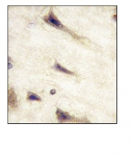 AM11061PU-N - EPHA5