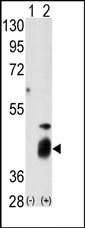 AP15266PU-N - DUSP7 / PYST2