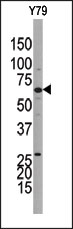AP15185PU-N - Guanylate cyclase soluble GUCY1B3