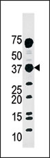 AP15180PU-N - Major Vault Protein