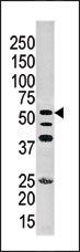 AP15174PU-N - ITPKA / IP3 3-kinase A