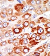 AP15163PU-N - Adenylate kinase 1 / AK1