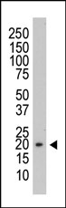 AM11084PU-N - PRL3 / PTP4A3