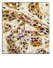 AP11003PU-N - PRMT1