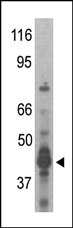 AP11013PU-N - PRMT6 / HRMT1L6