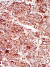 AP15121PU-N - Hexokinase-3