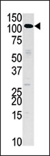 AP15122PU-N - Hexokinase-3