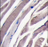 AP15124PU-N - Hexokinase-2