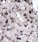 AP15125PU-N - Hexokinase-2