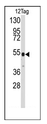 AP11020PU-N - Pk (V5) Epitope Tag (GKPIPNPLLGLDST)