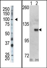 AP15128PU-N - Hexokinase-1