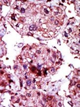 AP15128PU-N - Hexokinase-1
