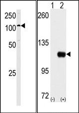 AP15129PU-N - Hexokinase-1