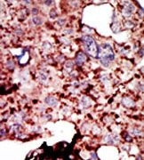 AP15129PU-N - Hexokinase-1