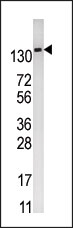 AP15138PU-N - PFKFB2