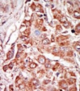 AP15147PU-N - EIF2AK2 / PKR