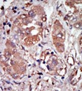 AP15148PU-N - EIF2AK2 / PKR