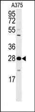 AP15151PU-N - 14-3-3 protein zeta/delta