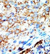 AP15153PU-N - NME4