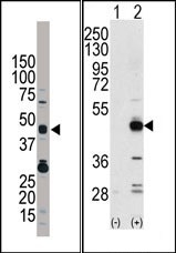 AP15157PU-N - TRIB3
