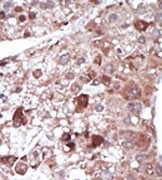 AP15049PU-N - PCK1 / PEPCK1