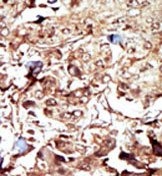 AP15051PU-N - PCK2