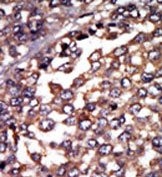 AP15053PU-N - PRKAR1A