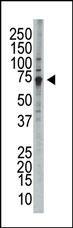 AP15063PU-N - WEE1 / Wee1-like protein kinase