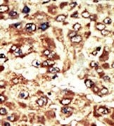 AP15063PU-N - WEE1 / Wee1-like protein kinase