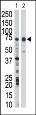 AP15064PU-N - WEE1 / Wee1-like protein kinase