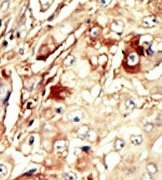 AP15064PU-N - WEE1 / Wee1-like protein kinase