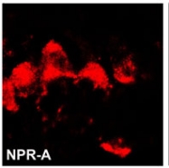AP15071PU-N - NPR1 / ANPRA