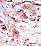 AP15071PU-N - NPR1 / ANPRA