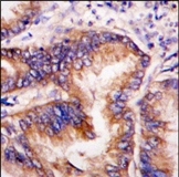 AP15077PU-N - EIF2AK1 / HRI