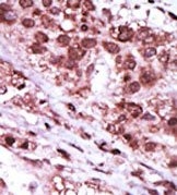 AP15080PU-N - GSK3 beta