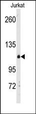 AP15092PU-N - DAG kinase delta