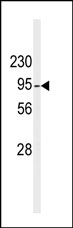 AP15094PU-N - DAG kinase beta